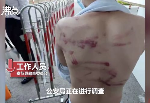 停职 警方介入